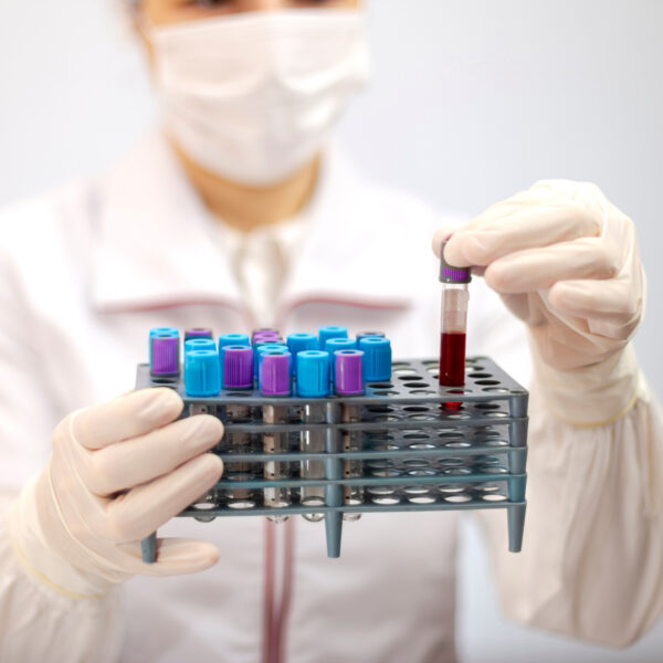Triple-S conducts epidemiologic study among employees and family members