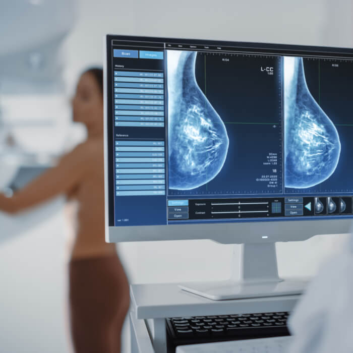 Cáncer de seno: señales que no debes ignorar