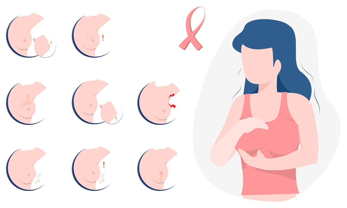 Síntomas del cáncer de seno